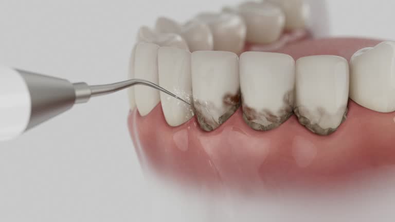 Reliable Dental Implants contractor in Melrose, MA by Smile Center Dentistry